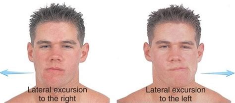 What is lateral excursion? | News | Dentagama