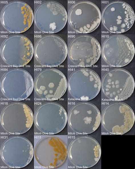 Frontiers | Metabolomic Diversity and Identification of Antibacterial Activities of Bacteria ...