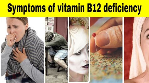 Symptoms of vitamin B12 deficiency - Vitamin Rush