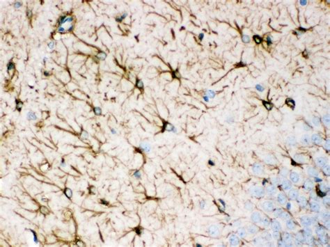 GFAP Antibody (monoclonal) - Novatein Biosciences