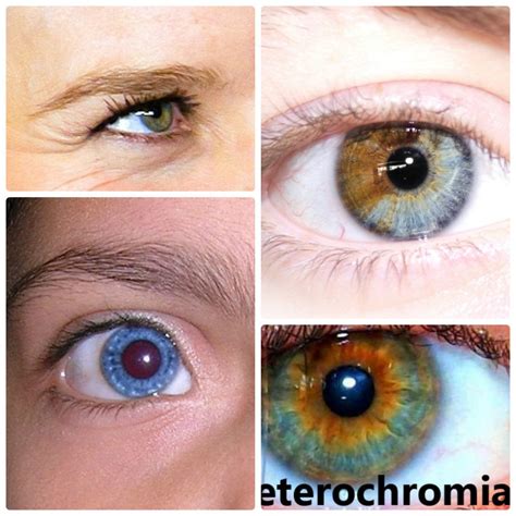 Heterochromia Iridum—People With Two Different Colored Eyes - Owlcation