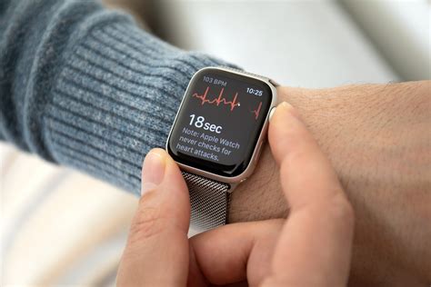 Smart Watches for AFib: Monitor Atrial Fibrillation Anytime, Anywhere ...