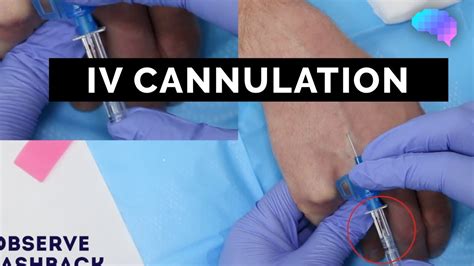 Intravenous (IV) cannulation | OSCE Guide | UKMLA | CPSA - YouTube