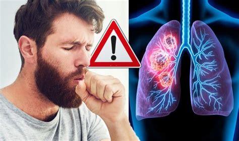 Lung cancer symptoms: Signs of a tumour when you cough include chest pain | Express.co.uk