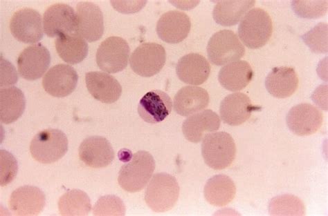 Free picture: thin, film, micrograph, plasmodium vivax, macrogametocyte
