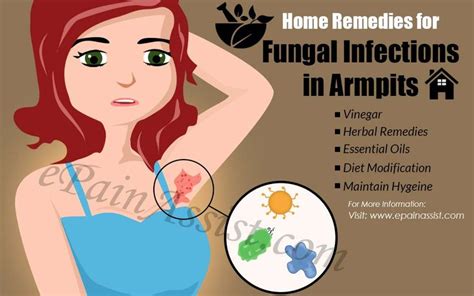 Home Remedies for Fungal Infections in Armpits | Fungal infection ...