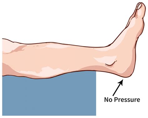 Skin & Pressure Sores; Care, Treatment & Prevention