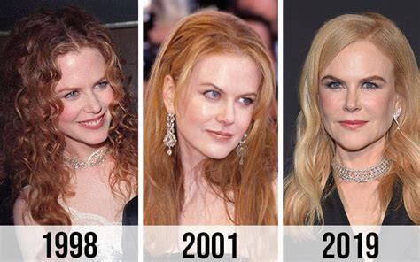 Nicole Kidman's Plastic Surgery: Before and After ...