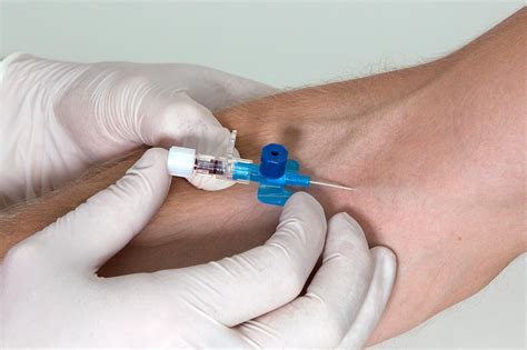 Intravenous Cannulation (IV) — Medistudents