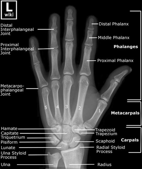 Wrist injuries – EMCAGE