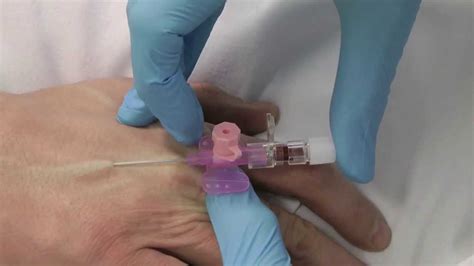 Cannulation- How to gain IV access - YouTube