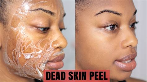 DEAD SKIN PEEL OFF MASK | Reduced Wrinkles, Remove Dark Marks & Shrink Pores ...