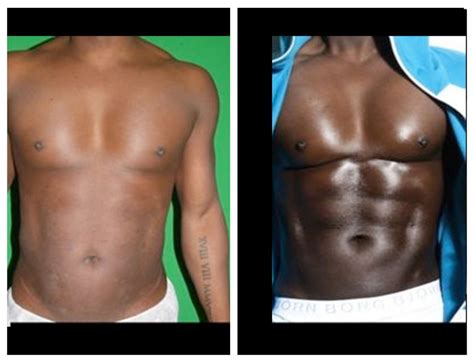 Abdominal Sculpting Liposuction for Men London | Hans Place Practice