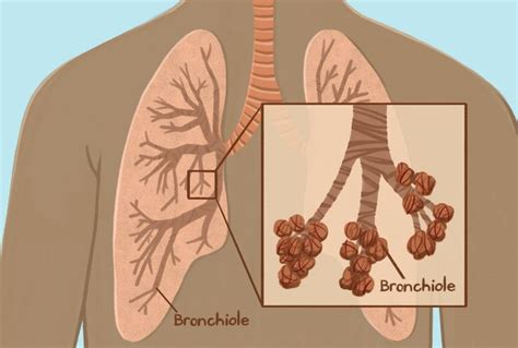 Bronchioles: Role in Lungs and Related Conditions