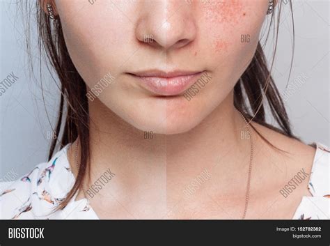 Before After Cosmetic Image & Photo (Free Trial) | Bigstock