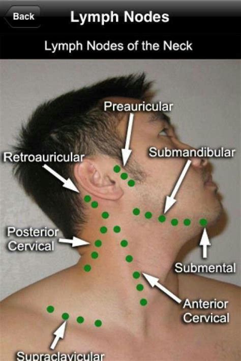 #MedicalVocabulary #VisualVocabulary Lymph node location and names for medical knowledge and ...