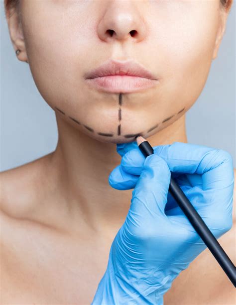Chin Cosmetic Surgery - Health Park Clinic