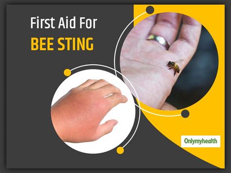 Bee Sting First Aid