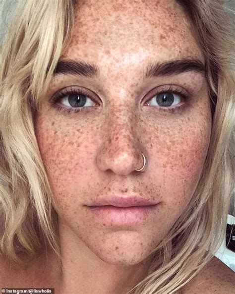 Kesha vows to love herself and let her 'freckles live' in gorgeous ...