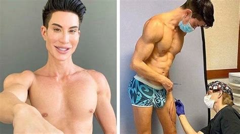 Botched Justin Plastic Surgery, Human Ken Doll Justin Jedlica Before ...