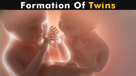 How Twins Are Formed? | Fraternal twins & identical twins (Urdu/Hindi ...