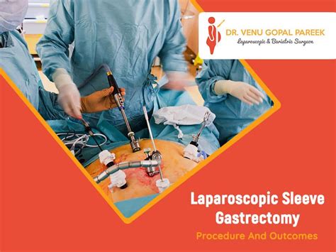 Laparoscopic Sleeve Gastrectomy-Procedure And Outcomes