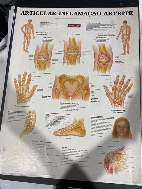 Medical Anatomy Posters, Health & Nutrition, Medical Supplies & Tools on Carousell