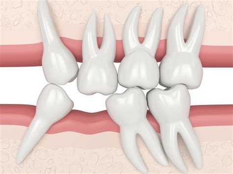 Know What Tooth Loss Could Really Mean | Conroe, TX