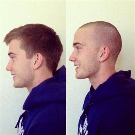 Buzz Cut Thinning Hair Before After Reddit A Comprehensive Guide - Best ...