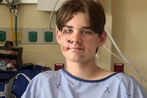 Teen Released From Hospital After Surviving 100-Foot Grand Canyon Fall - Free Beer and Hot Wings