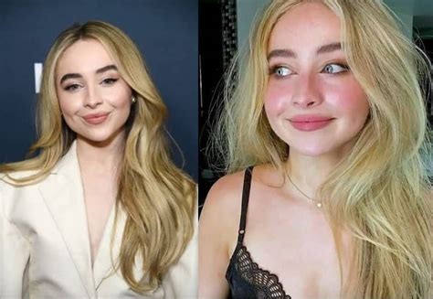 Sabrina Carpenter Plastic Surgery Before And After Photos