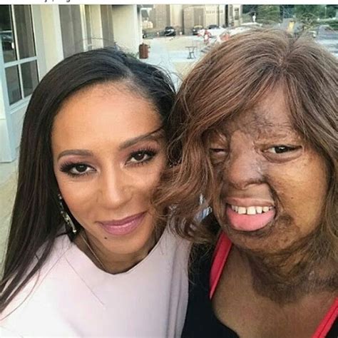 One Of The Only Two Sosoliso Plane Crash Survivors, Kechi Okwuchi With Singer MelB - MIMI'S BLOG