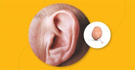 How to Choose the Best Invisible Hearing Aid for Your Needs - Centre For Hearing [Wiki]