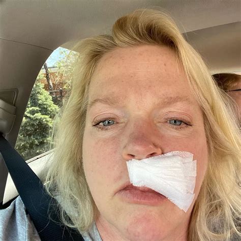 “Sister Wives’ Bombshell: Janelle Brown Stuns Fans with Shocking Skin Cancer Diagnosis – Unveils ...