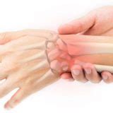 Wrist Pain Symptoms Causes Treatment Taping Exercises - vrogue.co