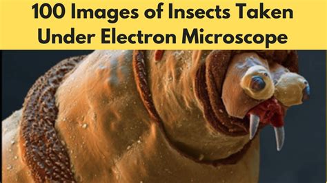 100 Images of Insects Taken Under Electron Microscope