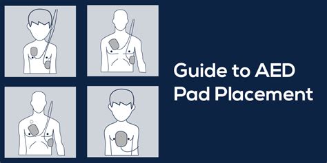 Guide to AED Pad Placement - MDPRO USA