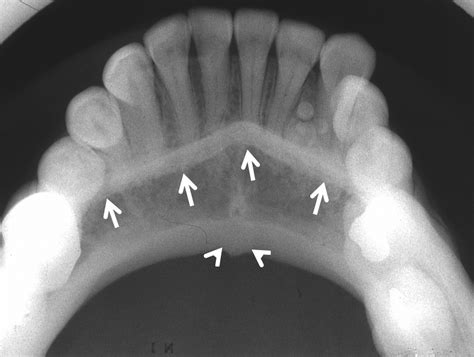 Oral and Maxillofacial Anatomy - Radiologic Clinics