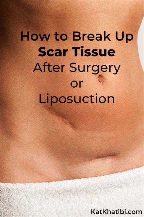 How To Break Up Scar Tissue After Surgery or Liposuction - Kat Khatibi Podcast and Wellness Blog ...