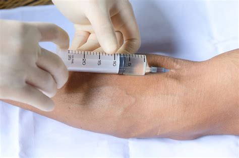 Facts about Intravenous Injection administration | veinscny.com