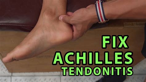 How to Fix Achilles Tendonitis In "4 Minutes" - YouTube