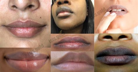 Can Smoking Cause Dark Lips | Lipstutorial.org