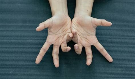 5 Acupressure Points For Psoriasis - Easy TCM Wisdom : Your Path to DIY Health and Wellness