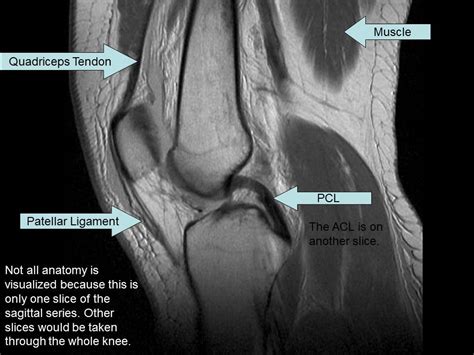 Magnetic Resonance Imaging - Knee Injury and Prevention