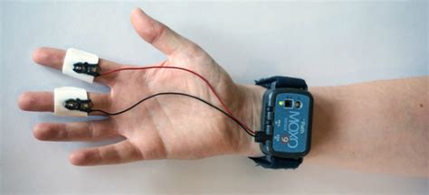 Wearable Measures Skin Conductance to Assess Emotions|Health Tech Insider