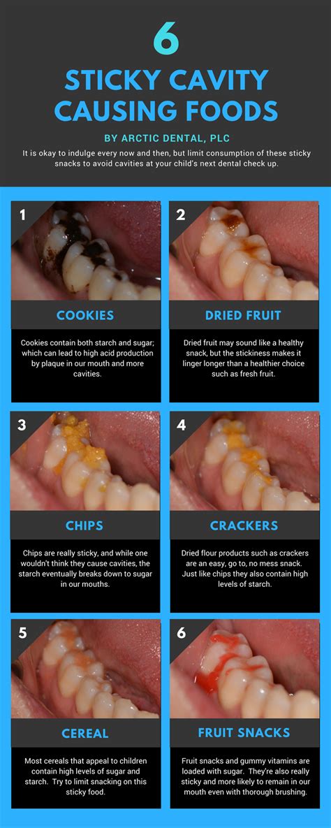 6 Sticky Cavity Causing Foods [Infographic] | Arctic Dental