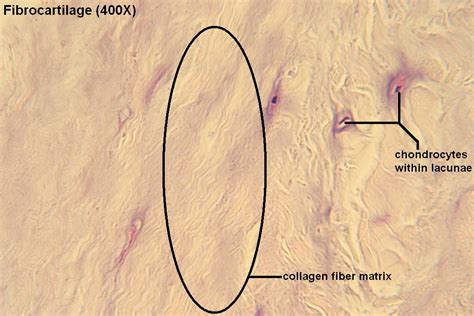 Fibrocartilage – Tutorial – Histology Atlas for Anatomy and Physiology