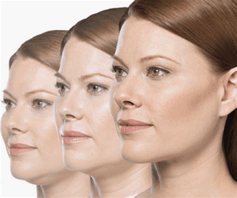 Top Jawline Treatments: Ultherapy, Thermitight, Sculptra, Kybella | Z Cosmetic Blog