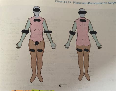 Chapter 19 Anatomy Rule of 9's Diagram | Quizlet