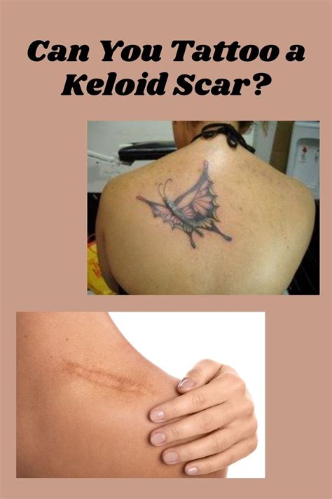 Keloid Tattoo Scar – Causes, Treatment, and Precautions - Tattoo Glee